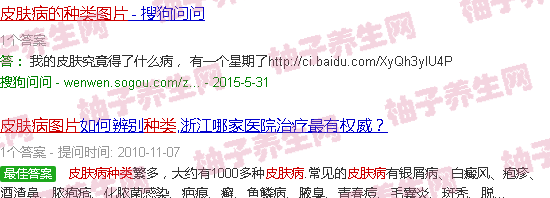  [皮肤病的种类图片大全]  皮肤病的种类图片大全对照症状 全身 
